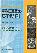 顎・口腔のCT・MRI