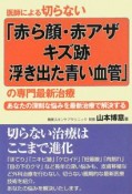 医師による切らない「赤ら顔・赤アザ・キズ跡・浮き出た青い血管」の専門最新治療