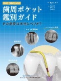 DHとDRのための歯周ポケット鑑別ガイド　その病変は本当にペリオ？