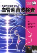 実症例の動画で学ぶ　血管超音波検査